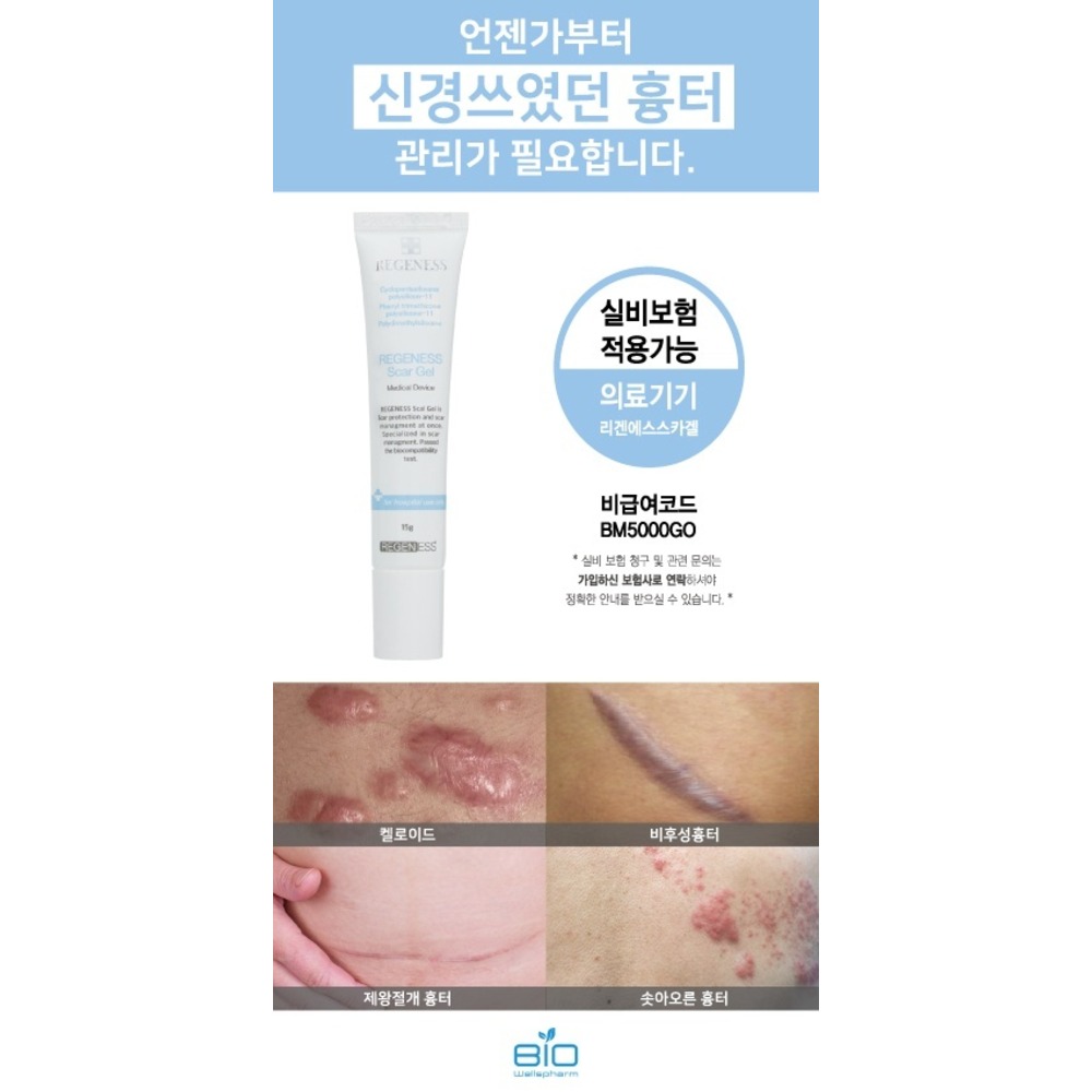 리겐에스스카겔_흉터이미지배너_원본비율_1000x1000.jpg